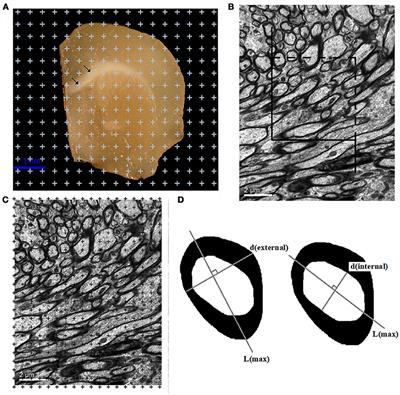 Sex Differences in the White Matter and Myelinated Fibers of APP/PS1 Mice and the Effects of Running Exercise on the Sex Differences of AD Mice
